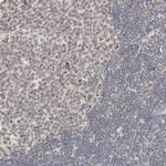 MAD1 Antibody in Immunohistochemistry (Paraffin) (IHC (P))