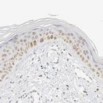 MAD1 Antibody in Immunohistochemistry (Paraffin) (IHC (P))