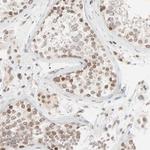 MAD1 Antibody in Immunohistochemistry (Paraffin) (IHC (P))
