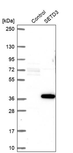 SETD3 Antibody in Western Blot (WB)