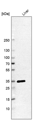TST Antibody in Western Blot (WB)