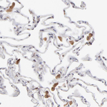 OAS1 Antibody in Immunohistochemistry (Paraffin) (IHC (P))