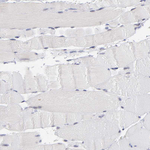 OAS1 Antibody in Immunohistochemistry (Paraffin) (IHC (P))