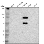 Factor XII Antibody in Western Blot (WB)