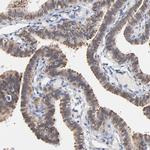 MIF Antibody in Immunohistochemistry (Paraffin) (IHC (P))