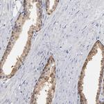 MIF Antibody in Immunohistochemistry (Paraffin) (IHC (P))