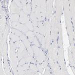 MIF Antibody in Immunohistochemistry (Paraffin) (IHC (P))