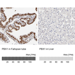 PBX1 Antibody in Immunohistochemistry (Paraffin) (IHC (P))