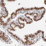 PBX1 Antibody in Immunohistochemistry (Paraffin) (IHC (P))