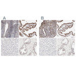 PBX1 Antibody in Immunohistochemistry (Paraffin) (IHC (P))