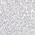 PBX1 Antibody in Immunohistochemistry (Paraffin) (IHC (P))