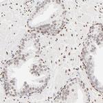 PBX1 Antibody in Immunohistochemistry (Paraffin) (IHC (P))
