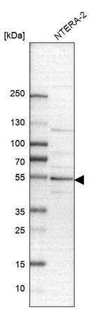 PBX1 Antibody in Western Blot (WB)