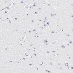 CD2 Antibody in Immunohistochemistry (Paraffin) (IHC (P))