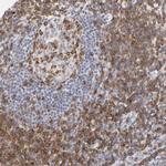 CD2 Antibody in Immunohistochemistry (Paraffin) (IHC (P))