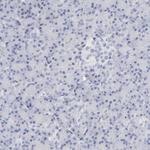 MCM7 Antibody in Immunohistochemistry (Paraffin) (IHC (P))