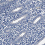 SOX6 Antibody in Immunohistochemistry (Paraffin) (IHC (P))