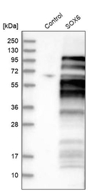 SOX6 Antibody in Western Blot (WB)