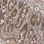 Cdc37 Antibody in Immunohistochemistry (Paraffin) (IHC (P))