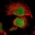 MLLT6 Polyclonal Antibody