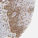 MLLT6 Antibody in Immunohistochemistry (Paraffin) (IHC (P))