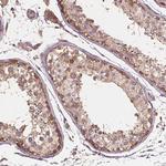 G3BP1 Antibody in Immunohistochemistry (Paraffin) (IHC (P))