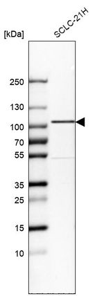 GIT1 Antibody in Western Blot (WB)