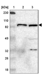 GIT1 Antibody in Western Blot (WB)
