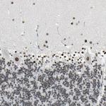 ZIC1 Antibody in Immunohistochemistry (Paraffin) (IHC (P))