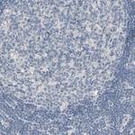 ZIC1 Antibody in Immunohistochemistry (Paraffin) (IHC (P))