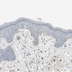 ZIC1 Antibody in Immunohistochemistry (Paraffin) (IHC (P))