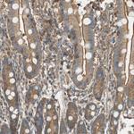 PI4K2B Antibody in Immunohistochemistry (Paraffin) (IHC (P))