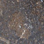 PI4K2B Antibody in Immunohistochemistry (Paraffin) (IHC (P))