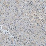 PI4K2B Antibody in Immunohistochemistry (Paraffin) (IHC (P))