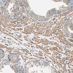 PI4K2B Antibody in Immunohistochemistry (Paraffin) (IHC (P))