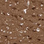 WAVE1 Polyclonal Antibody