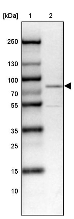 WAVE1 Antibody in Western Blot (WB)