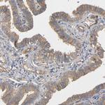 MARS Antibody in Immunohistochemistry (Paraffin) (IHC (P))