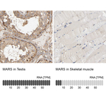 MARS Antibody in Immunohistochemistry (Paraffin) (IHC (P))