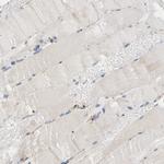 MARS Antibody in Immunohistochemistry (Paraffin) (IHC (P))