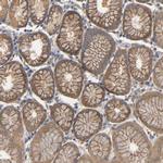 MARS Antibody in Immunohistochemistry (Paraffin) (IHC (P))