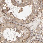 MARS Antibody in Immunohistochemistry (Paraffin) (IHC (P))