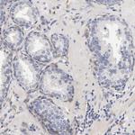 Laminin beta-1 Antibody in Immunohistochemistry (Paraffin) (IHC (P))