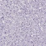 CUBN Antibody in Immunohistochemistry (Paraffin) (IHC (P))