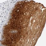 CRABP2 Antibody in Immunohistochemistry (Paraffin) (IHC (P))