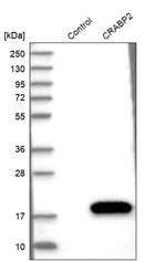CRABP2 Antibody in Western Blot (WB)