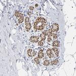 RUNX1 Antibody in Immunohistochemistry (Paraffin) (IHC (P))