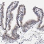 RUNX1 Antibody in Immunohistochemistry (Paraffin) (IHC (P))
