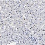 RUNX1 Antibody in Immunohistochemistry (Paraffin) (IHC (P))