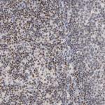 RUNX1 Antibody in Immunohistochemistry (Paraffin) (IHC (P))